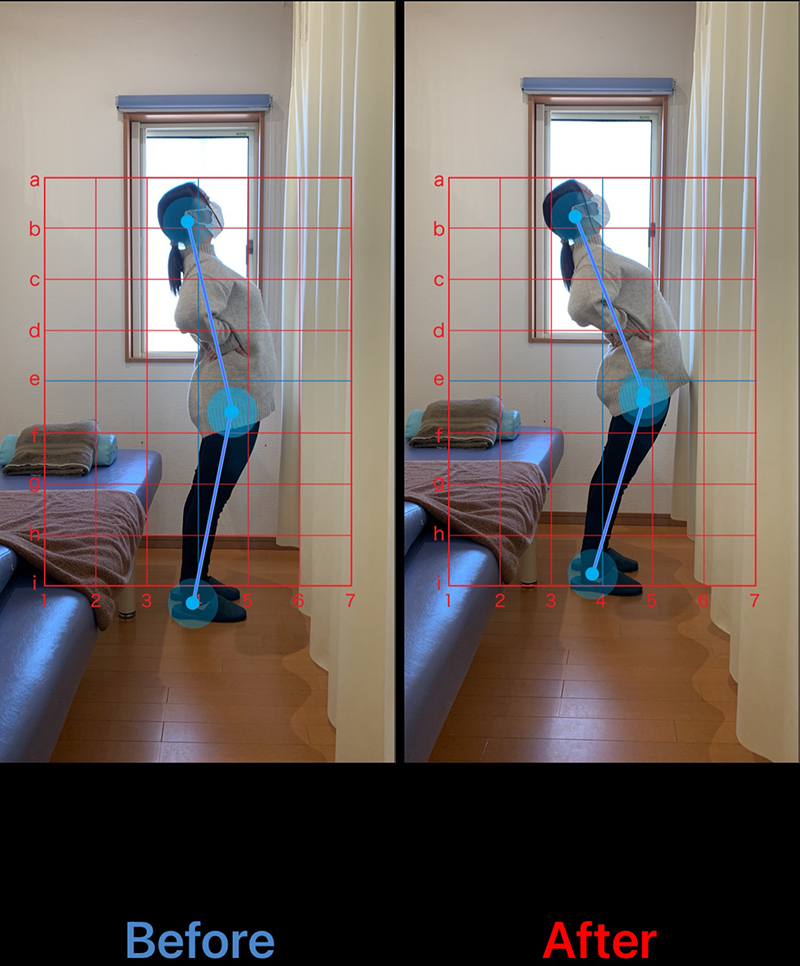 30代 女性 肩こり