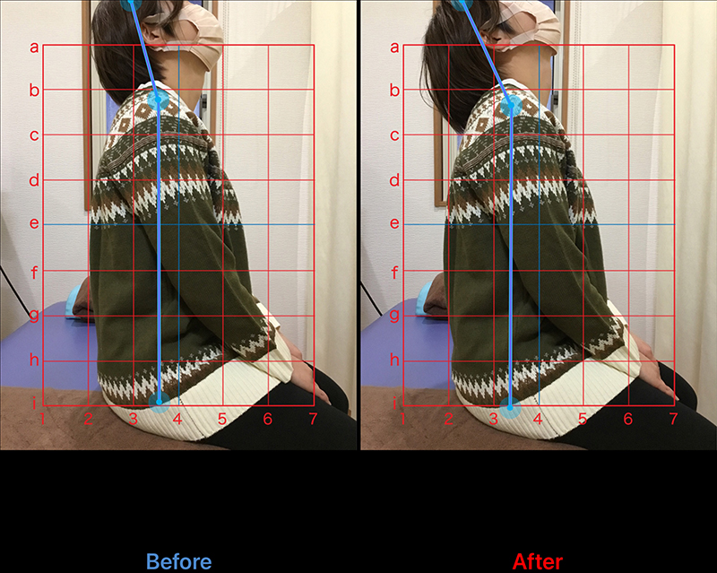 30代 女性 肩こり・腰痛